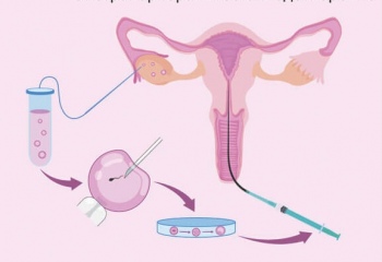 Эко: плюсы и минусы
